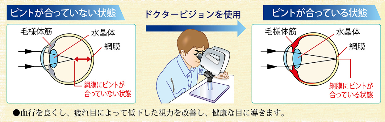 両眼式超音波治療器の効果