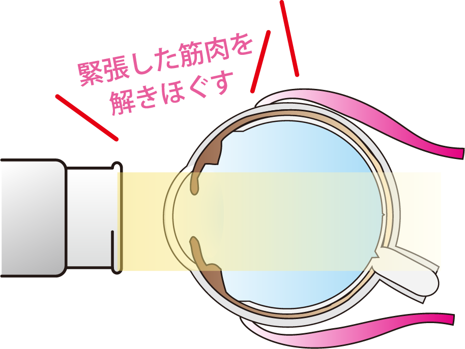 超音波治療器の作用